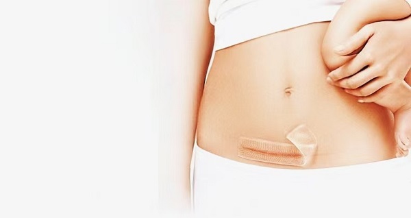 Pourquoi les feuilles épaisses de gel de silicone contre les cicatrices sont-elles si populaires ?