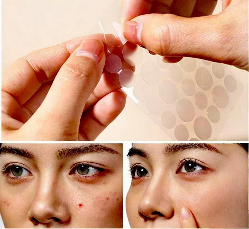 Comment utiliser les patchs CmallBio Pimple pendant la nuit pour des résultats optimaux ?
